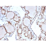 Immunohistochemistry - Anti-MSH2 Antibody [MSH2/2622] (A249381) - Antibodies.com