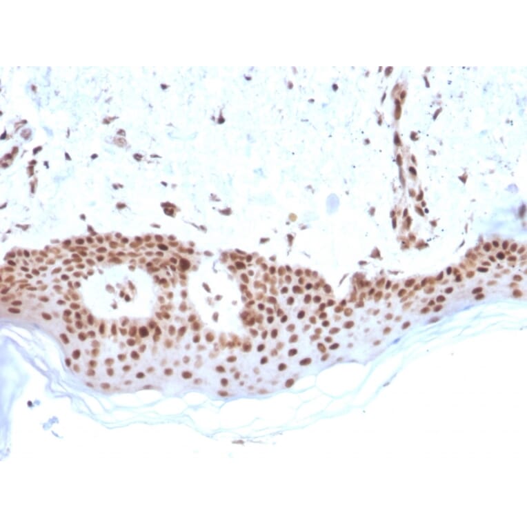 Immunohistochemistry - Anti-MSH2 Antibody [MSH2/2622] (A249381) - Antibodies.com