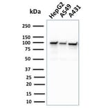 Western Blot - Anti-MSH2 Antibody [MSH2/2622] (A249381) - Antibodies.com