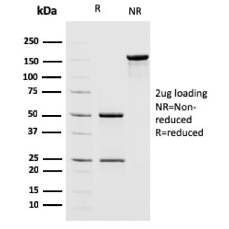 SDS-PAGE - Anti-MSH2 Antibody [MSH2/2622] (A249381) - Antibodies.com