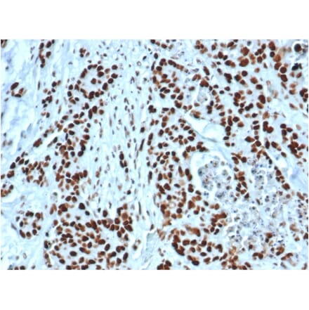 Immunohistochemistry - Anti-MSH2 Antibody [MSH2/6549R] (A249382) - Antibodies.com