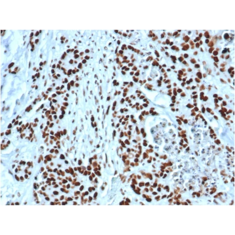 Immunohistochemistry - Anti-MSH2 Antibody [MSH2/6549R] (A249382) - Antibodies.com