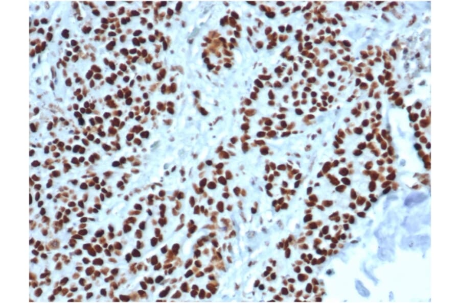 Immunohistochemistry - Anti-MSH2 Antibody [MSH2/6549R] (A249381) - Antibodies.com