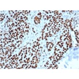 Immunohistochemistry - Anti-MSH2 Antibody [MSH2/6549R] (A249381) - Antibodies.com