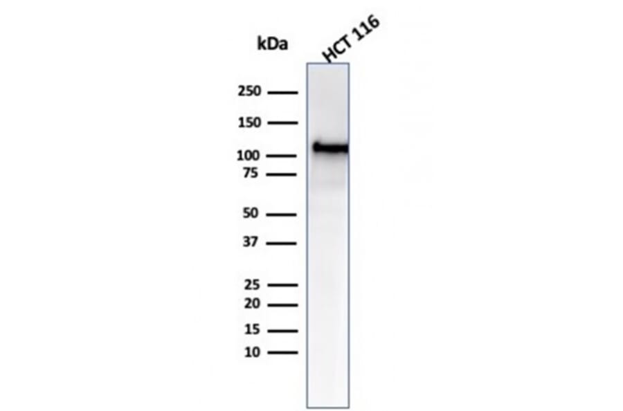 Western Blot - Anti-MSH2 Antibody [MSH2/6549R] (A249382) - Antibodies.com