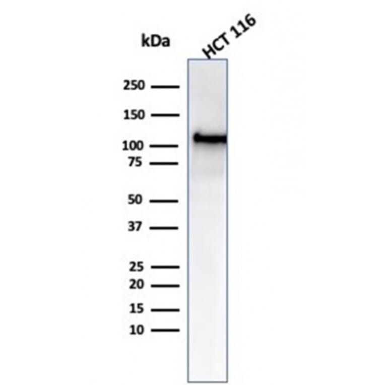 Western Blot - Anti-MSH2 Antibody [MSH2/6549R] (A249382) - Antibodies.com