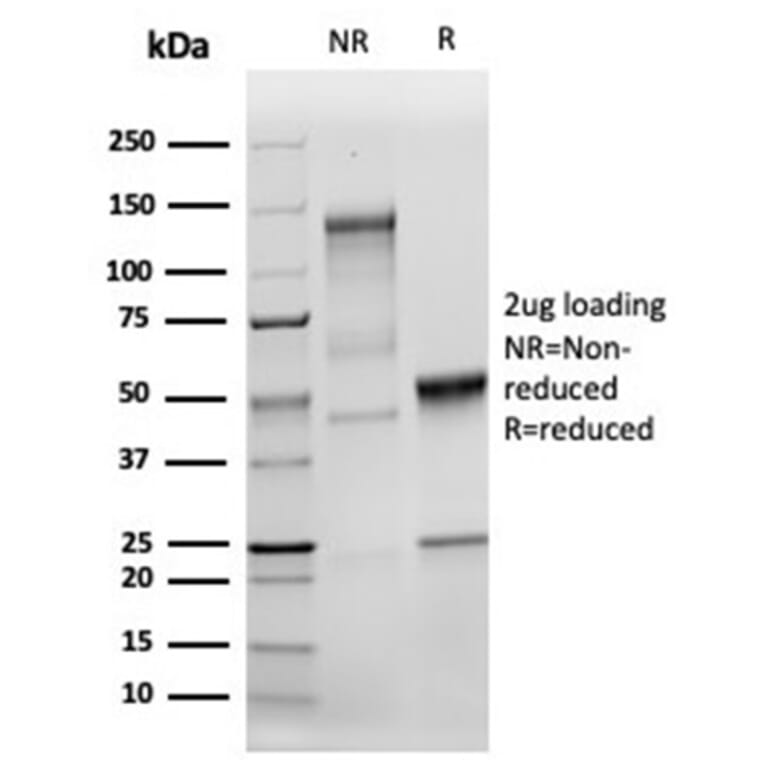 SDS-PAGE - Anti-MSH2 Antibody [MSH2/6549R] (A249382) - Antibodies.com