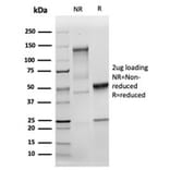 SDS-PAGE - Anti-MSH2 Antibody [MSH2/6549R] (A249382) - Antibodies.com