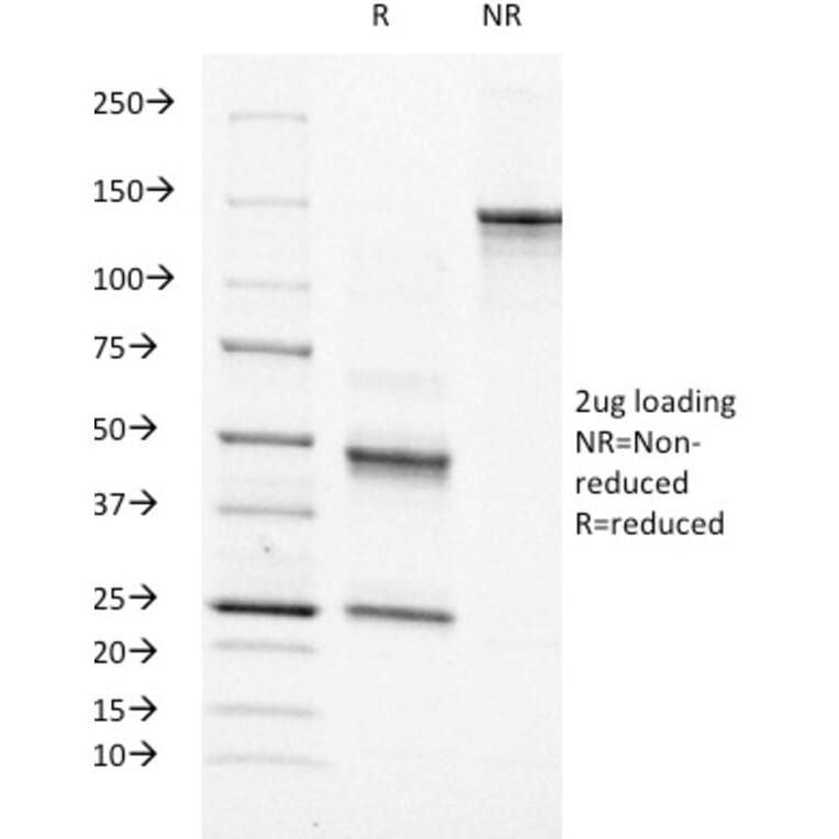 SDS-PAGE - Anti-Moesin Antibody [MSN/491] (A249383) - Antibodies.com