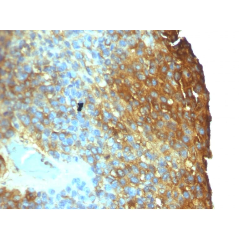 Immunohistochemistry - Anti-Moesin Antibody [SPM562] (A249384) - Antibodies.com