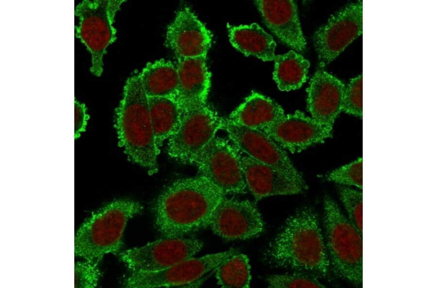 Immunofluorescence - Anti-Moesin Antibody [SPM562] (A249383) - Antibodies.com