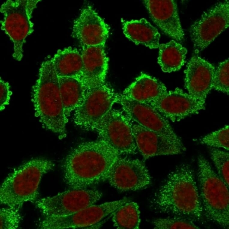 Immunofluorescence - Anti-Moesin Antibody [SPM562] (A249383) - Antibodies.com