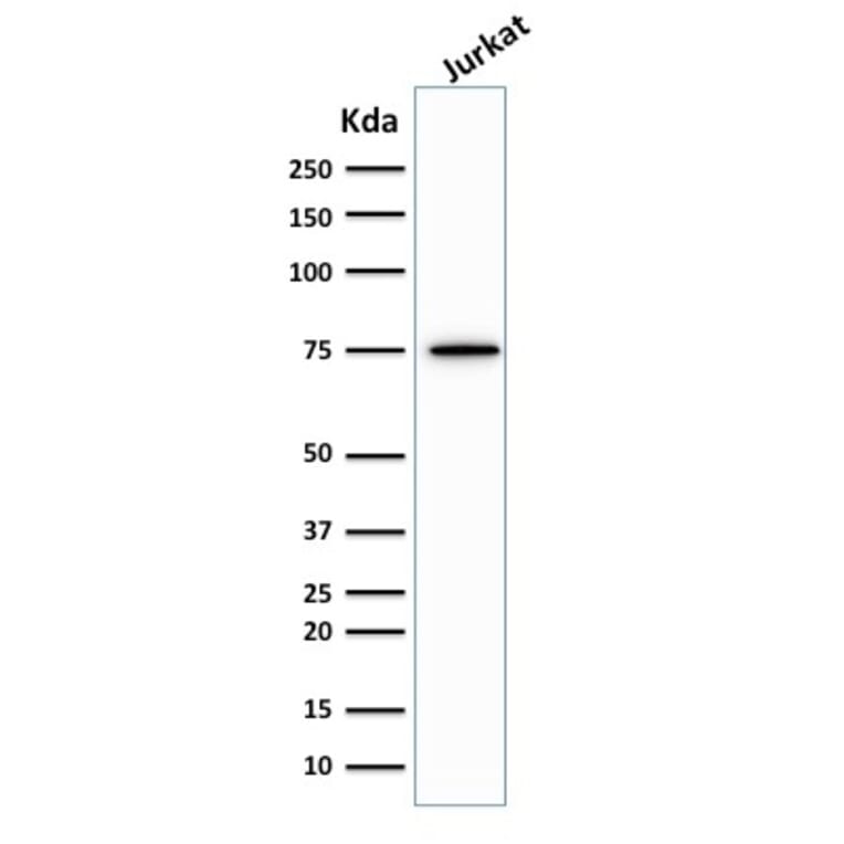 Western Blot - Anti-Moesin Antibody [MSN/492] (A249385) - Antibodies.com