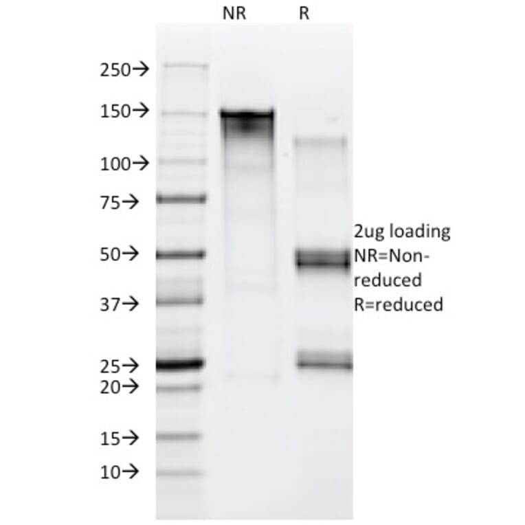 SDS-PAGE - Anti-Moesin Antibody [MSN/492] (A249385) - Antibodies.com