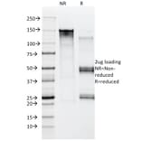 SDS-PAGE - Anti-Moesin Antibody [MSN/492] (A249385) - Antibodies.com