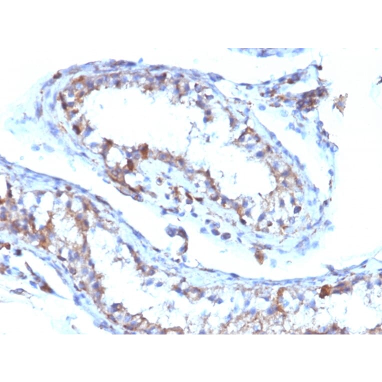 Immunohistochemistry - Anti-Moesin Antibody [MSN/493] (A249386) - Antibodies.com