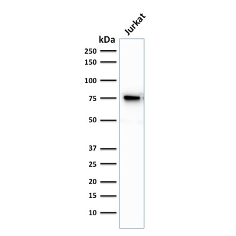 Western Blot - Anti-Moesin Antibody [MSN/493] (A249386) - Antibodies.com