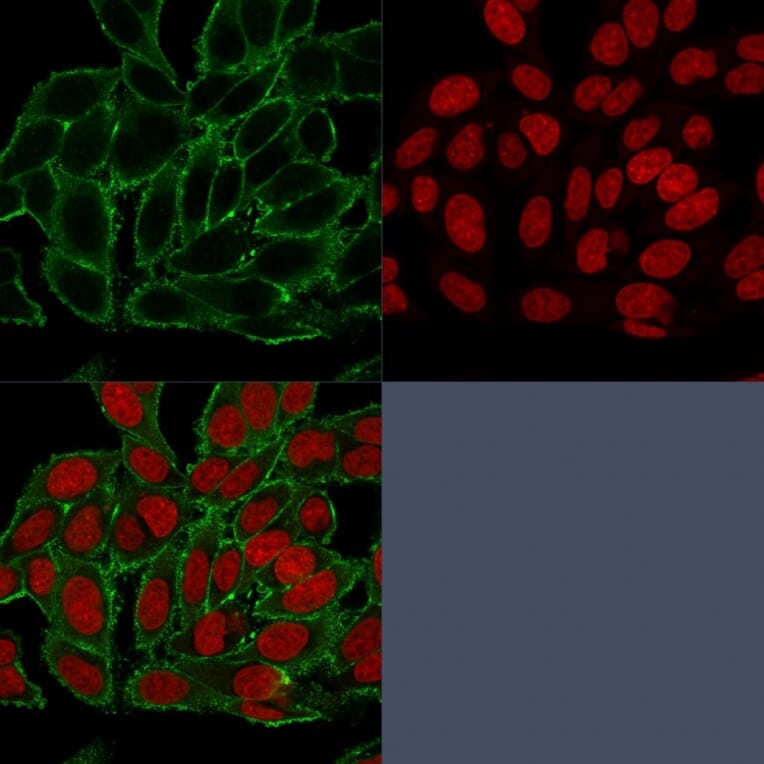 Immunofluorescence - Anti-Moesin Antibody [MSN/493] (A249386) - Antibodies.com