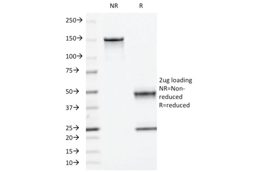 SDS-PAGE - Anti-Moesin Antibody [MSN/493] (A249386) - Antibodies.com