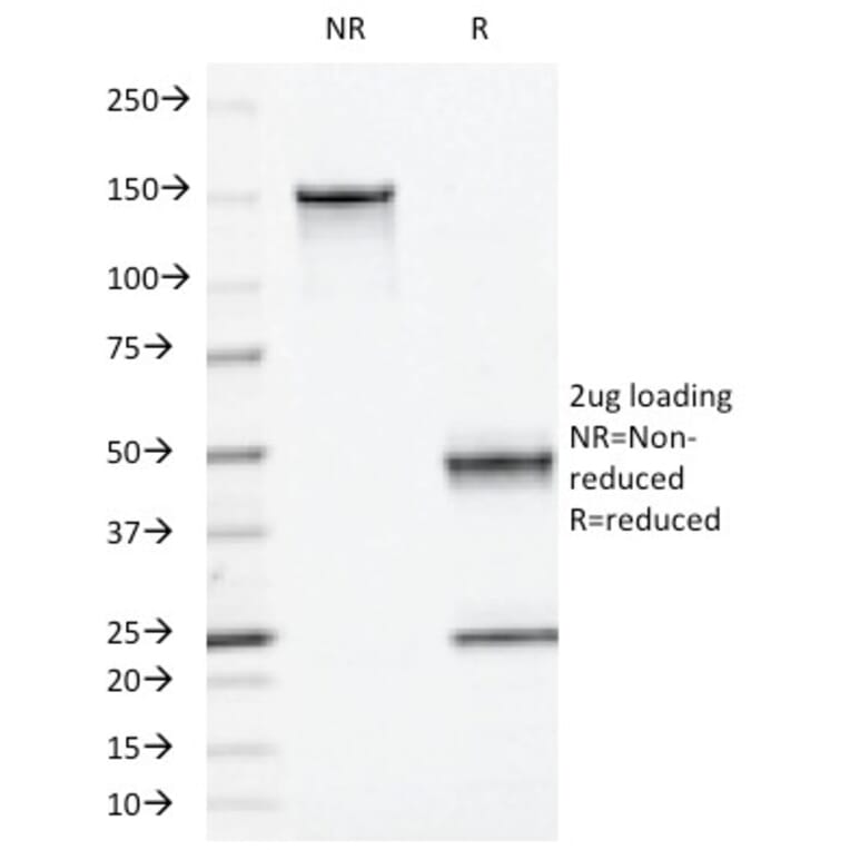 SDS-PAGE - Anti-Moesin Antibody [MSN/493] (A249386) - Antibodies.com