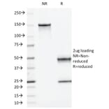 SDS-PAGE - Anti-Moesin Antibody [MSN/493] (A249386) - Antibodies.com