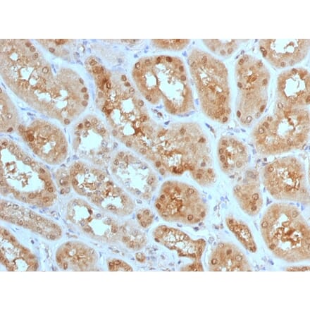 Immunohistochemistry - Anti-MTAP Antibody [MTAP/1813] (A249388) - Antibodies.com