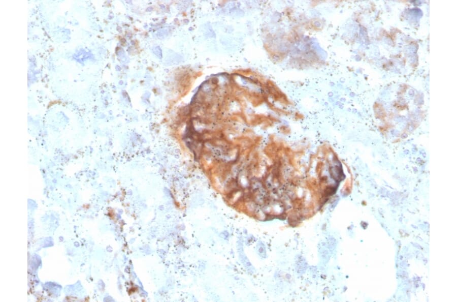 Immunohistochemistry - Anti-MTAP Antibody [rMTAP/1813] (A249389) - Antibodies.com