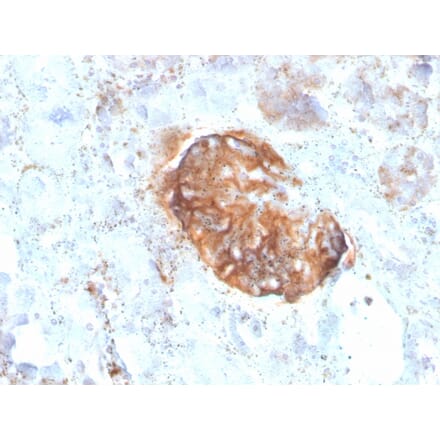Immunohistochemistry - Anti-MTAP Antibody [rMTAP/1813] (A249389) - Antibodies.com
