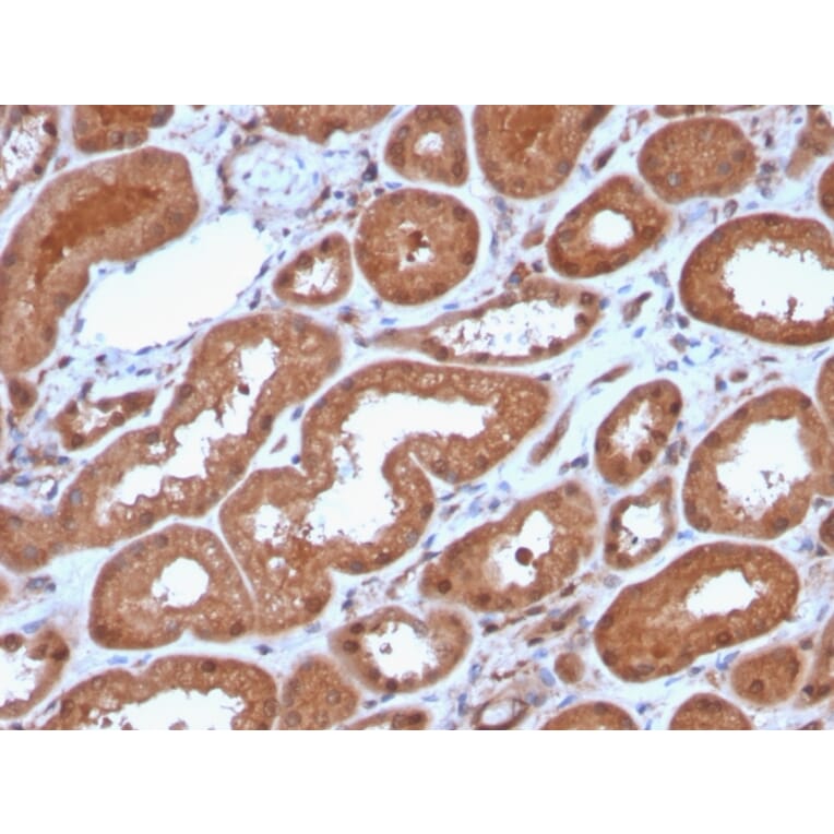 Immunohistochemistry - Anti-MTAP Antibody [MTAP/3137R] (A249389) - Antibodies.com