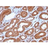 Immunohistochemistry - Anti-MTAP Antibody [MTAP/3137R] (A249389) - Antibodies.com