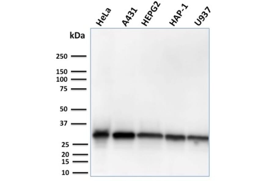 Western Blot - Anti-MTAP Antibody [MTAP/3137R] (A249390) - Antibodies.com