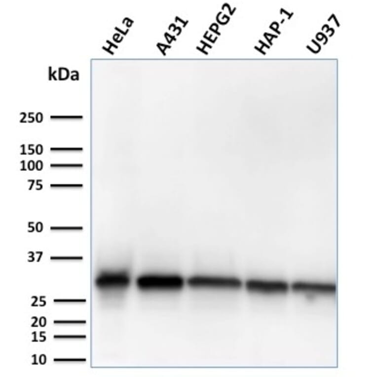 Western Blot - Anti-MTAP Antibody [MTAP/3137R] (A249390) - Antibodies.com