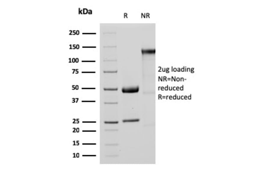 SDS-PAGE - Anti-MTAP Antibody [MTAP/3137R] (A249390) - Antibodies.com