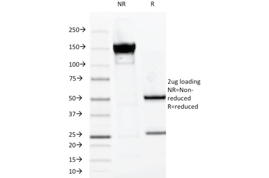 SDS-PAGE - Anti-MUC1 Antibody [VU-2G7] (A249391) - Antibodies.com
