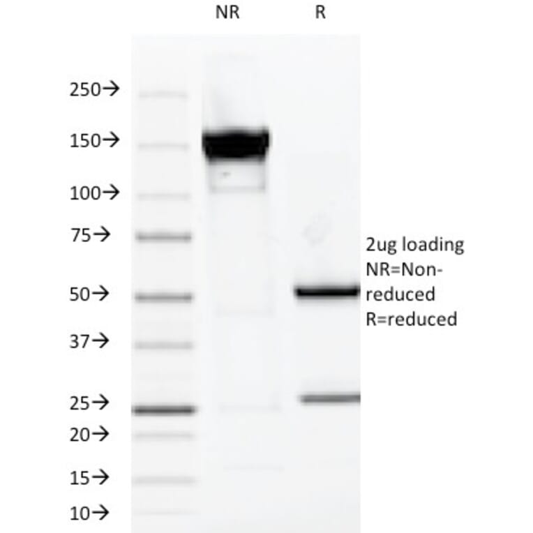 SDS-PAGE - Anti-MUC1 Antibody [VU-2G7] (A249391) - Antibodies.com