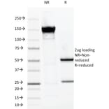 SDS-PAGE - Anti-MUC1 Antibody [VU-2G7] (A249391) - Antibodies.com