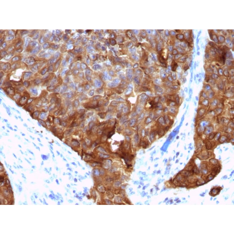 Immunohistochemistry - Anti-MUC1 Antibody [VU-4H5] (A249392) - Antibodies.com