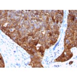 Immunohistochemistry - Anti-MUC1 Antibody [VU-4H5] (A249392) - Antibodies.com