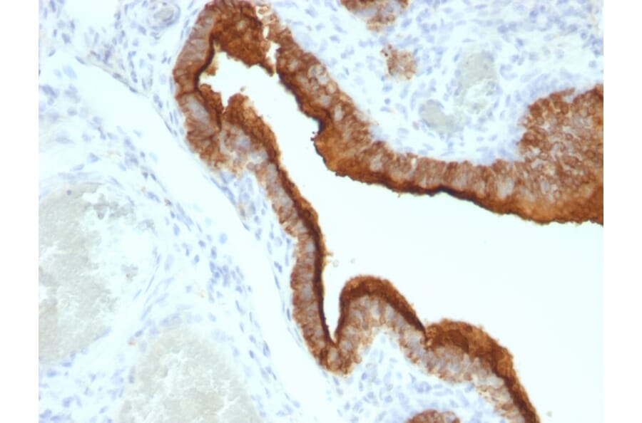 Immunohistochemistry - Anti-MUC1 Antibody [HMPV] (A249395) - Antibodies.com
