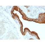Immunohistochemistry - Anti-MUC1 Antibody [HMPV] (A249395) - Antibodies.com