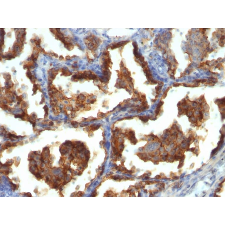 Immunohistochemistry - Anti-MUC1 Antibody [MUC1/955] (A249396) - Antibodies.com