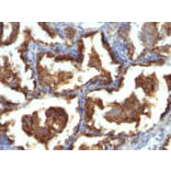 Immunohistochemistry - Anti-MUC1 Antibody [MUC1/955] (A249396) - Antibodies.com