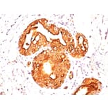 Immunohistochemistry - Anti-MUC1 Antibody [MUC1/955] (A249395) - Antibodies.com