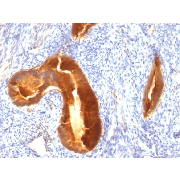 Immunohistochemistry - Anti-MUC1 Antibody [MUC1/955] (A249396) - Antibodies.com