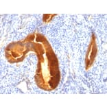 Immunohistochemistry - Anti-MUC1 Antibody [MUC1/955] (A249396) - Antibodies.com