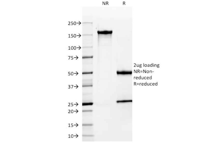 SDS-PAGE - Anti-MUC1 Antibody [MUC1/955] (A249396) - Antibodies.com