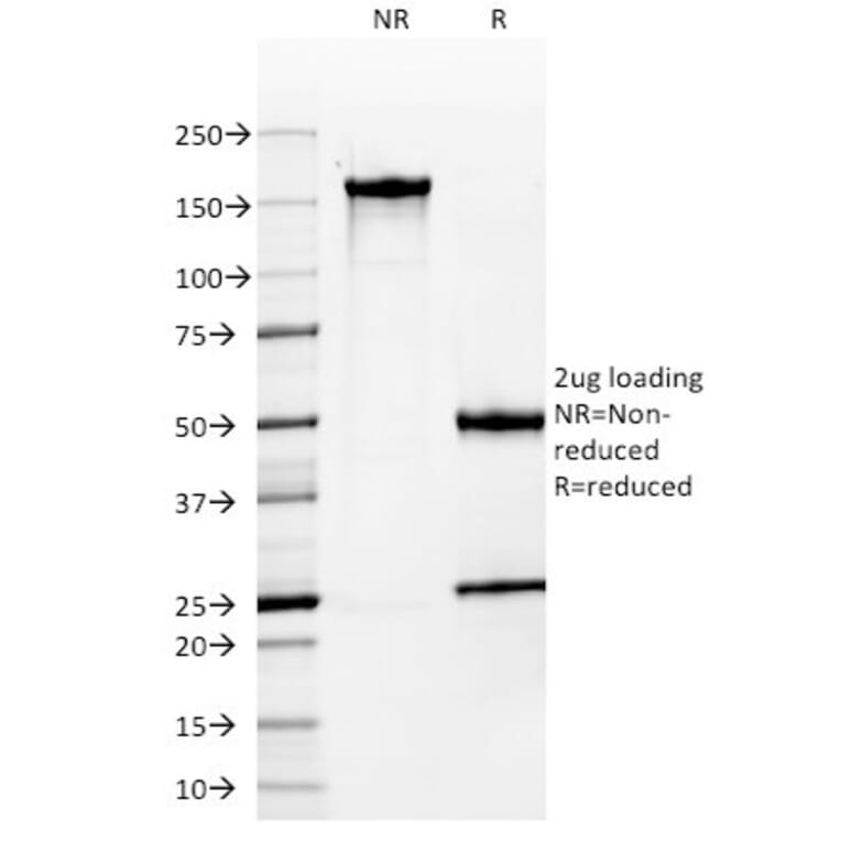 SDS-PAGE - Anti-MUC1 Antibody [MUC1/955] (A249396) - Antibodies.com