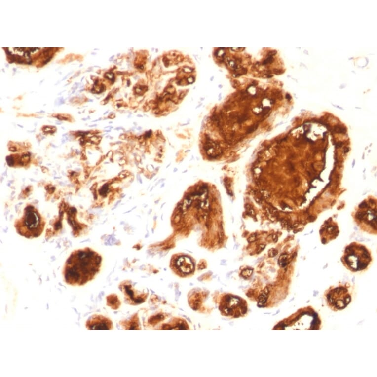 Immunohistochemistry - Anti-MUC1 Antibody [rMUC1/960] (A249396) - Antibodies.com