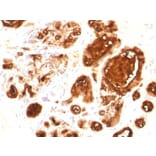 Immunohistochemistry - Anti-MUC1 Antibody [rMUC1/960] (A249396) - Antibodies.com