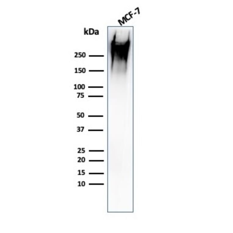 Western Blot - Anti-MUC1 Antibody [rMUC1/960] (A249397) - Antibodies.com